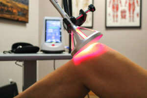 Knee Laser Treatments